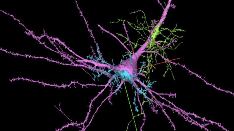 Harvard ve Google AI ile Beynin En Detayli Haritasini Olusturdu