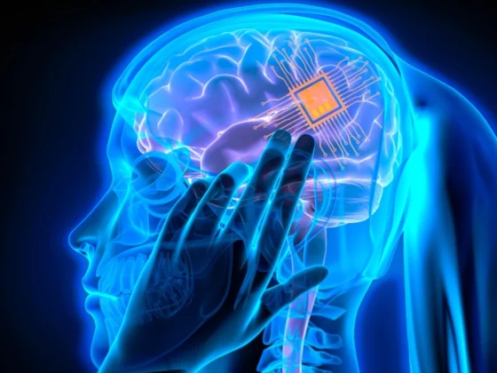 Beyin İmplantı